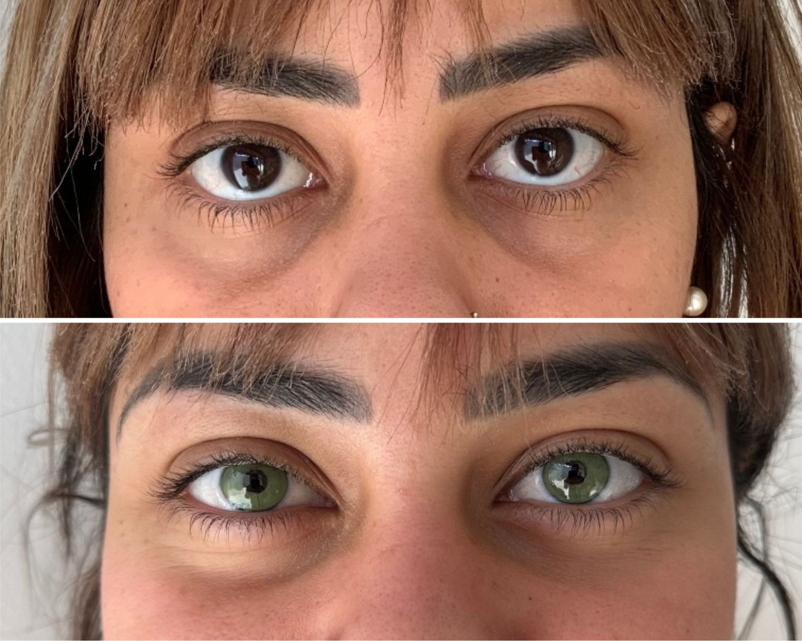 What Is Pigmentation In The Eye