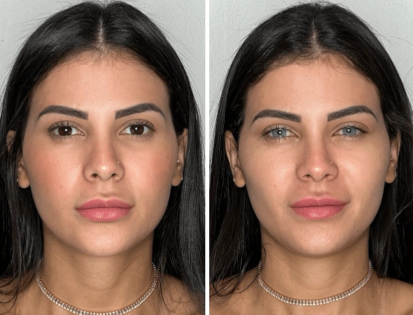 glutathione eye color before and after L-Glutathione Power  Vitopia Care